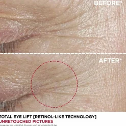 Clarins Kasvojenhoito<Total eye lift silmänympärysvoide täyttöpakkaus 15ml