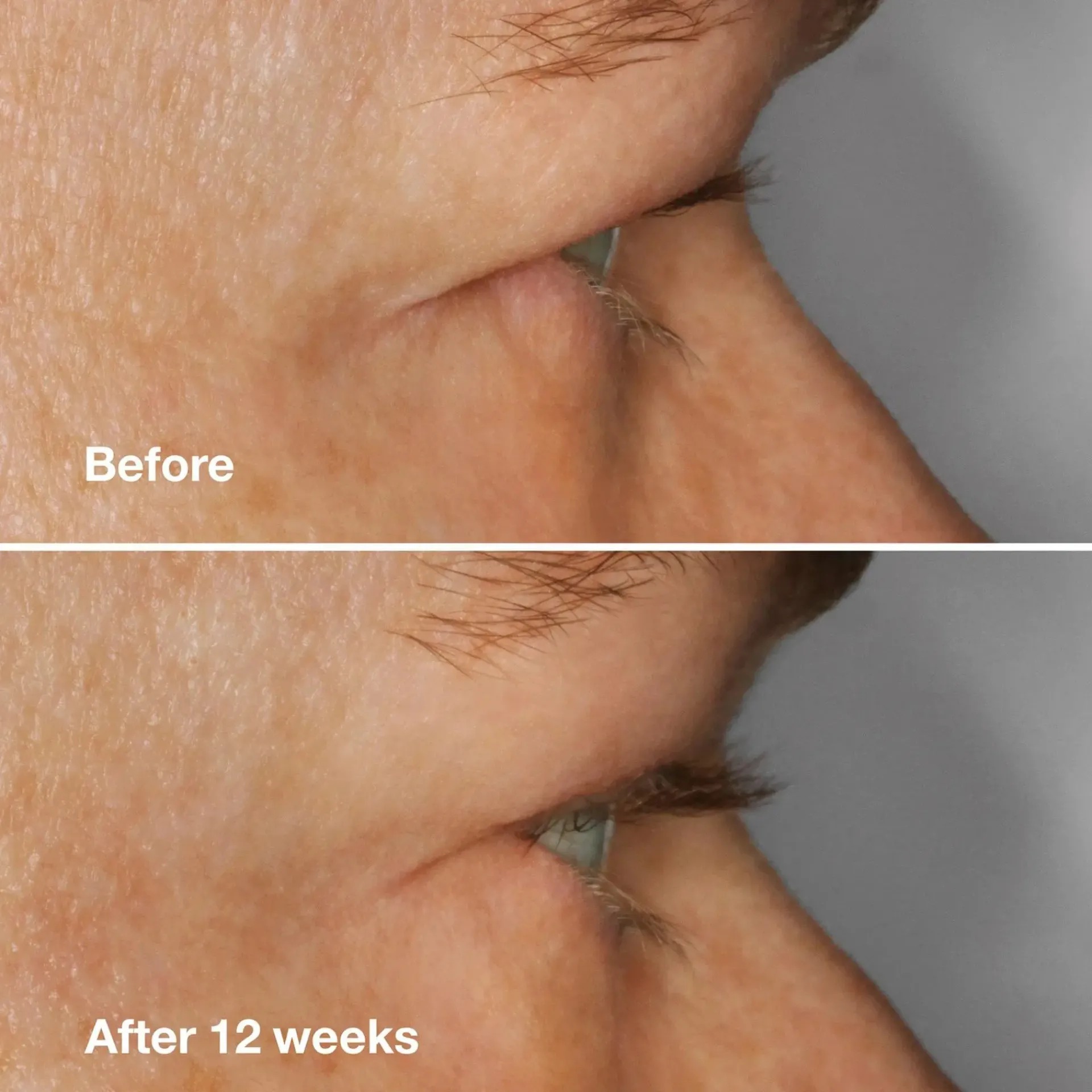 Clinique Hajusteettomat Meikit|Silmämeikit<High Impact Lash Amplifying Serum ripsiseerumi 3 ml