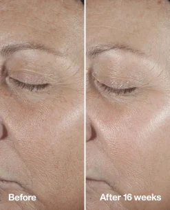 Clinique Hajusteettomat Ihonhoidon Tuotteet|Ihonhoidon Tehoaineet<Smart Clinical Repair Seerumi 50 ml