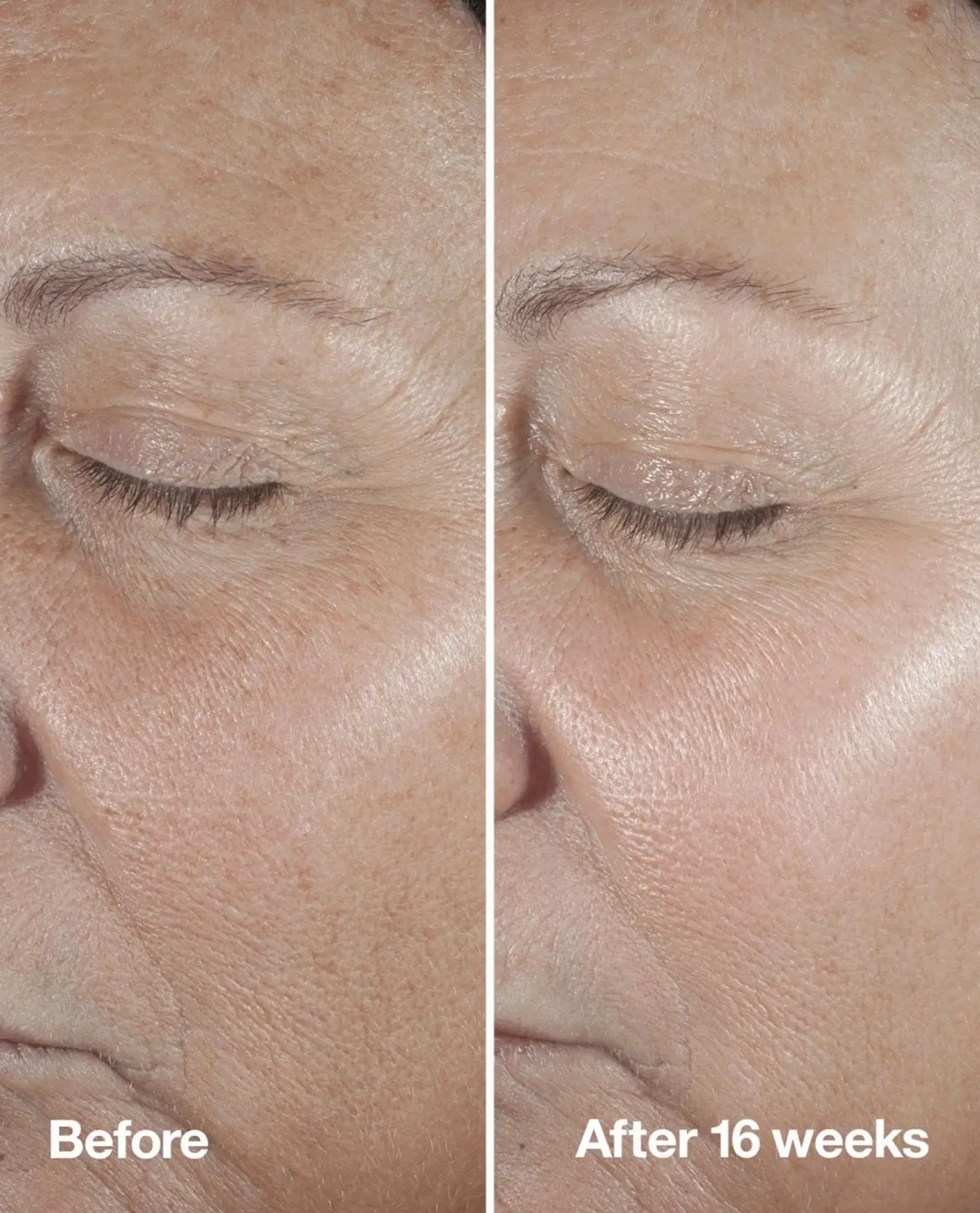 Clinique Hajusteettomat Ihonhoidon Tuotteet|Kasvojenhoito<Smart Clinical Repair Seerumi 30 ml