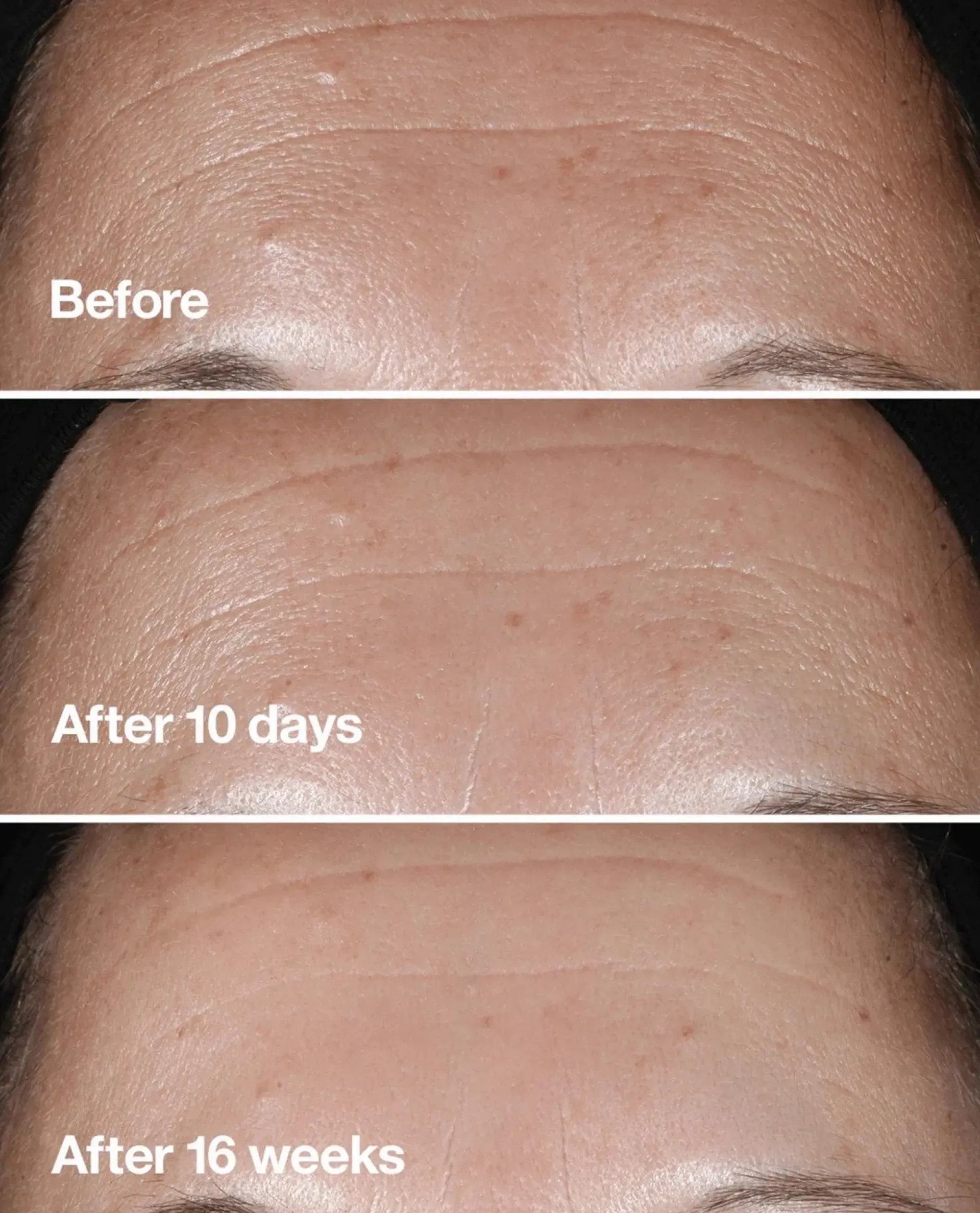 Clinique Hajusteettomat Ihonhoidon Tuotteet|Kasvojenhoito<Smart Clinical Repair Seerumi 30 ml
