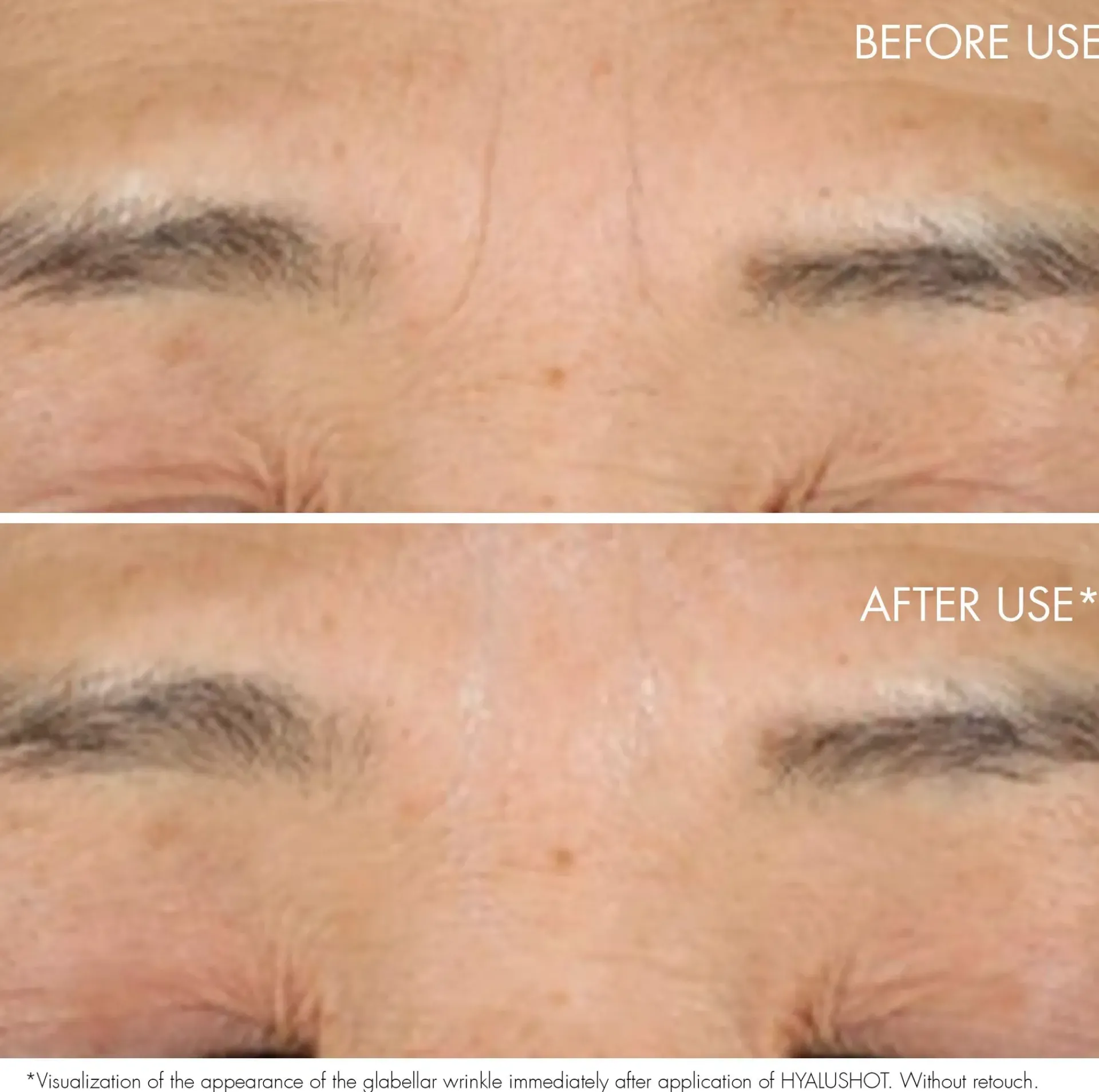 DIOR Kasvojenhoito<Capture Totale Hyalushot Wrinkle Corrector 15 ml