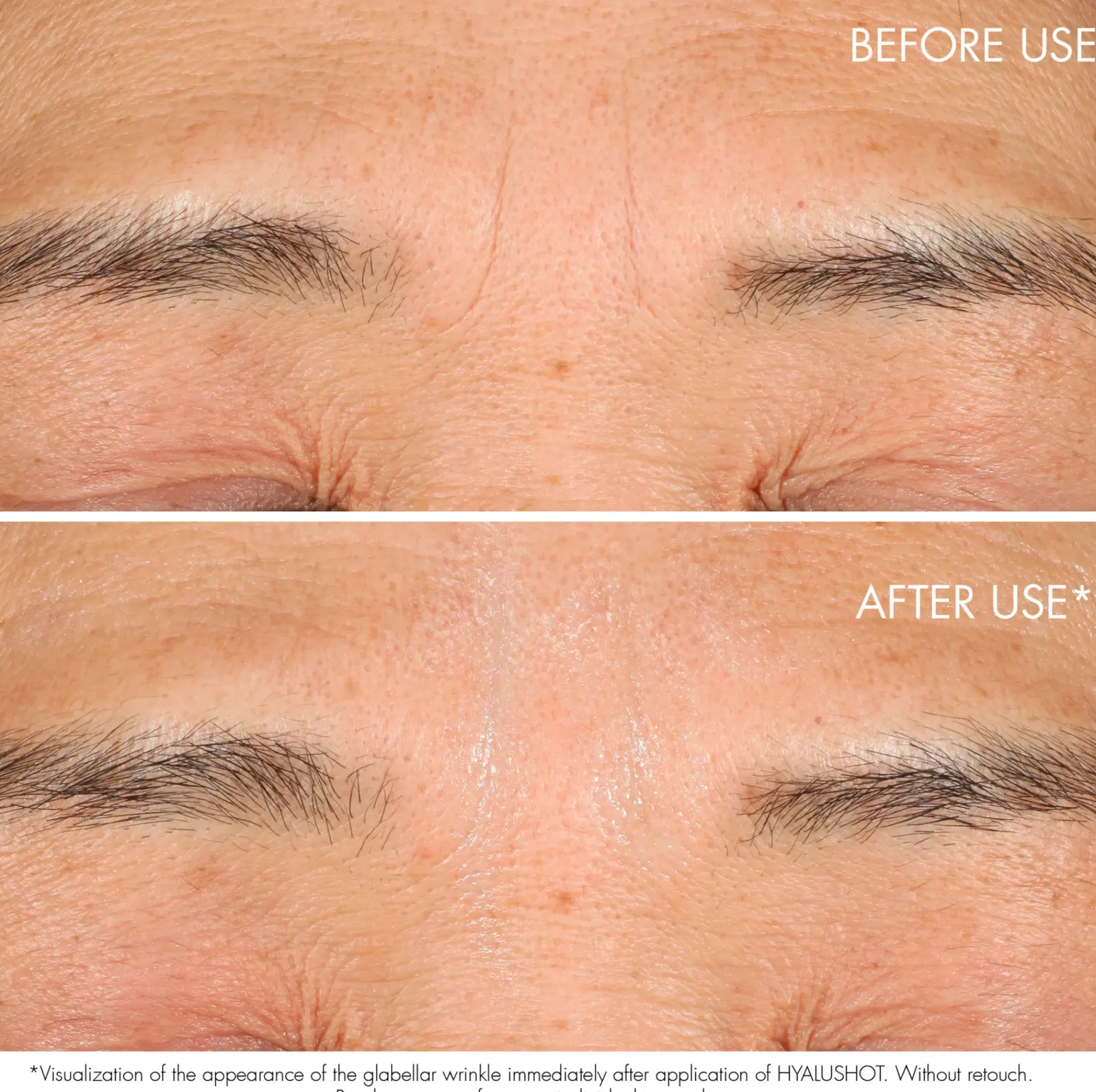 DIOR Ihonhoidon Tehoaineet|Kasvojenhoito<Capture Totale Retishot Retinol Skin Quality Renewer yötiiviste 20 ml