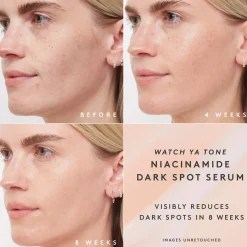 Fenty Skin Ihonhoidon Tehoaineet|Kasvojenhoito<Watch Ya Tone Niacinamide Dark Spot Seerumi 30 ml
