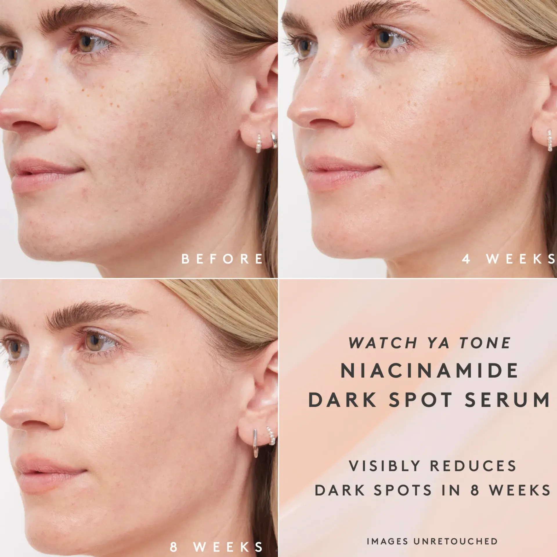 Fenty Skin Ihonhoidon Tehoaineet|Kasvojenhoito<Watch Ya Tone Niacinamide Dark Spot Seerumi 30 ml