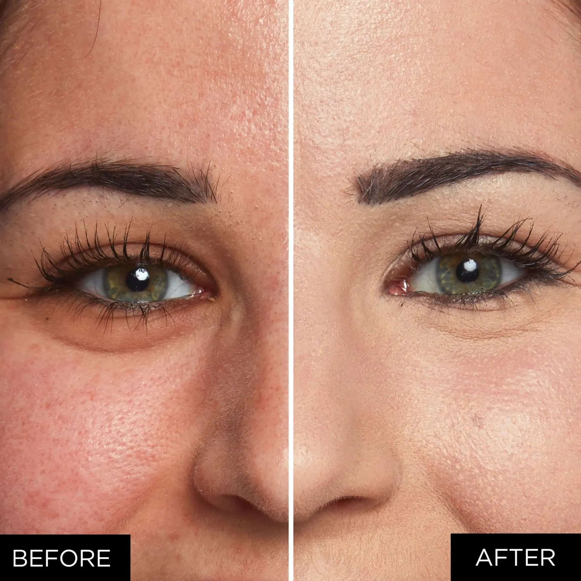 L'Oréal Paris Kasvomeikit<Infaillible More Than Concealer 325 Bisque peitevoide 11ml