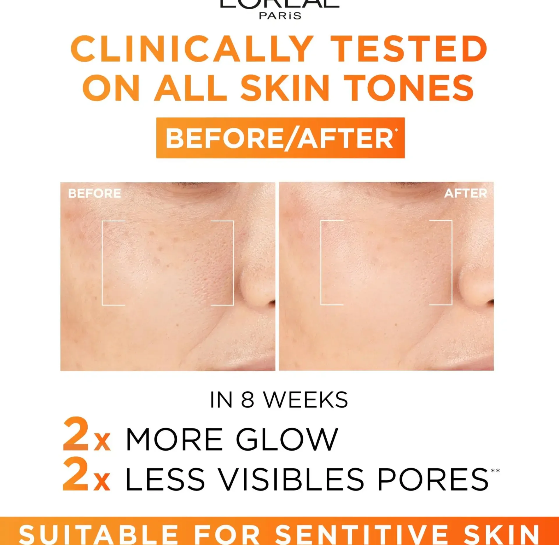 L'Oréal Paris Ihonhoidon Tehoaineet|Kasvojenhoito<Revitalift Clinical 12% Pure Vitamin C Serum seerumi normaalille iholle 30ml