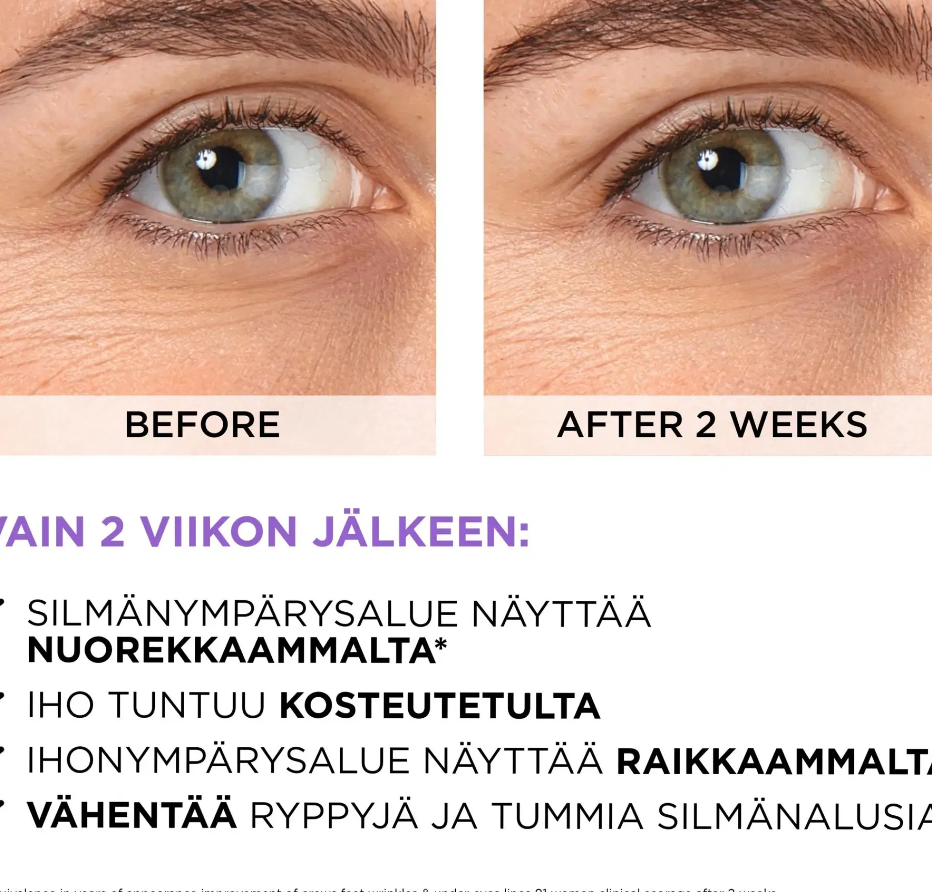 L'Oréal Paris Ihonhoidon Tehoaineet|Kasvojenhoito<Revitalift Filler 2,5% Hyaluronic Acid + Caffein Eye Serum silmänympärysalueelle 20 ml