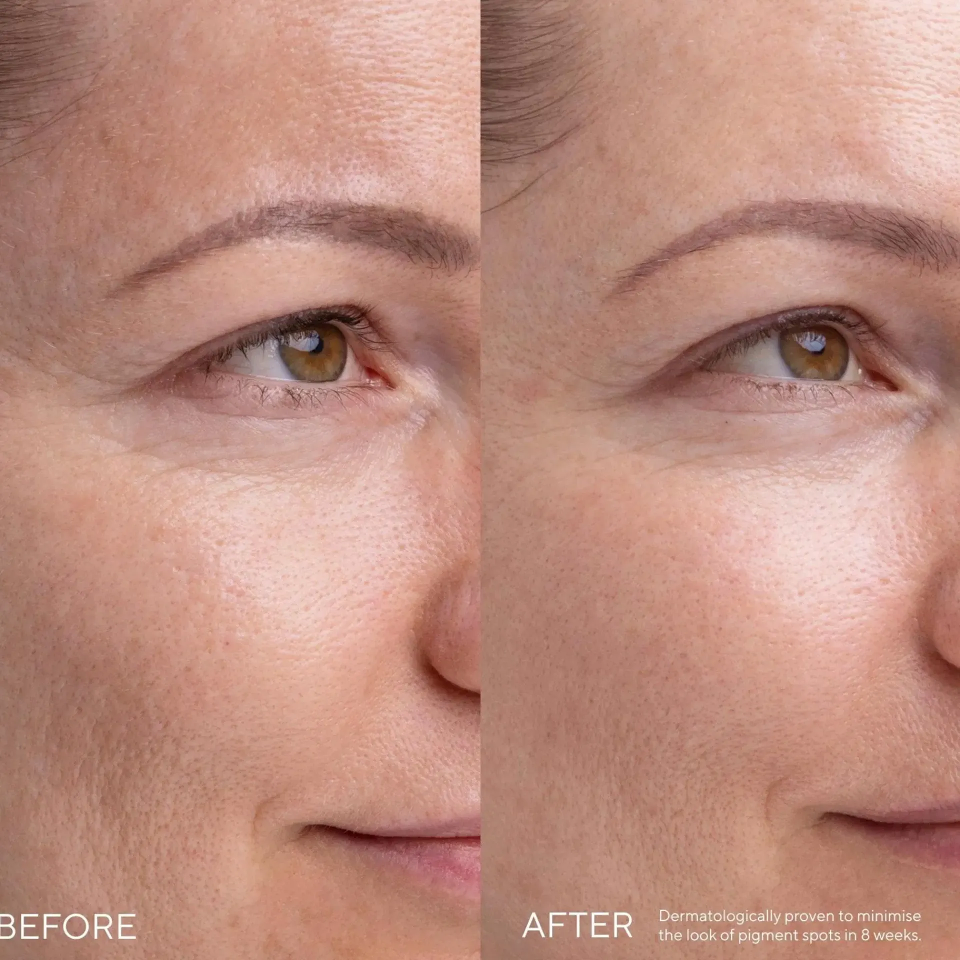 MÁDARA Ihonhoito|Kasvojenhoito<MADARA KOJIC ALTERNATIVE Pigment -seerumi 30ml