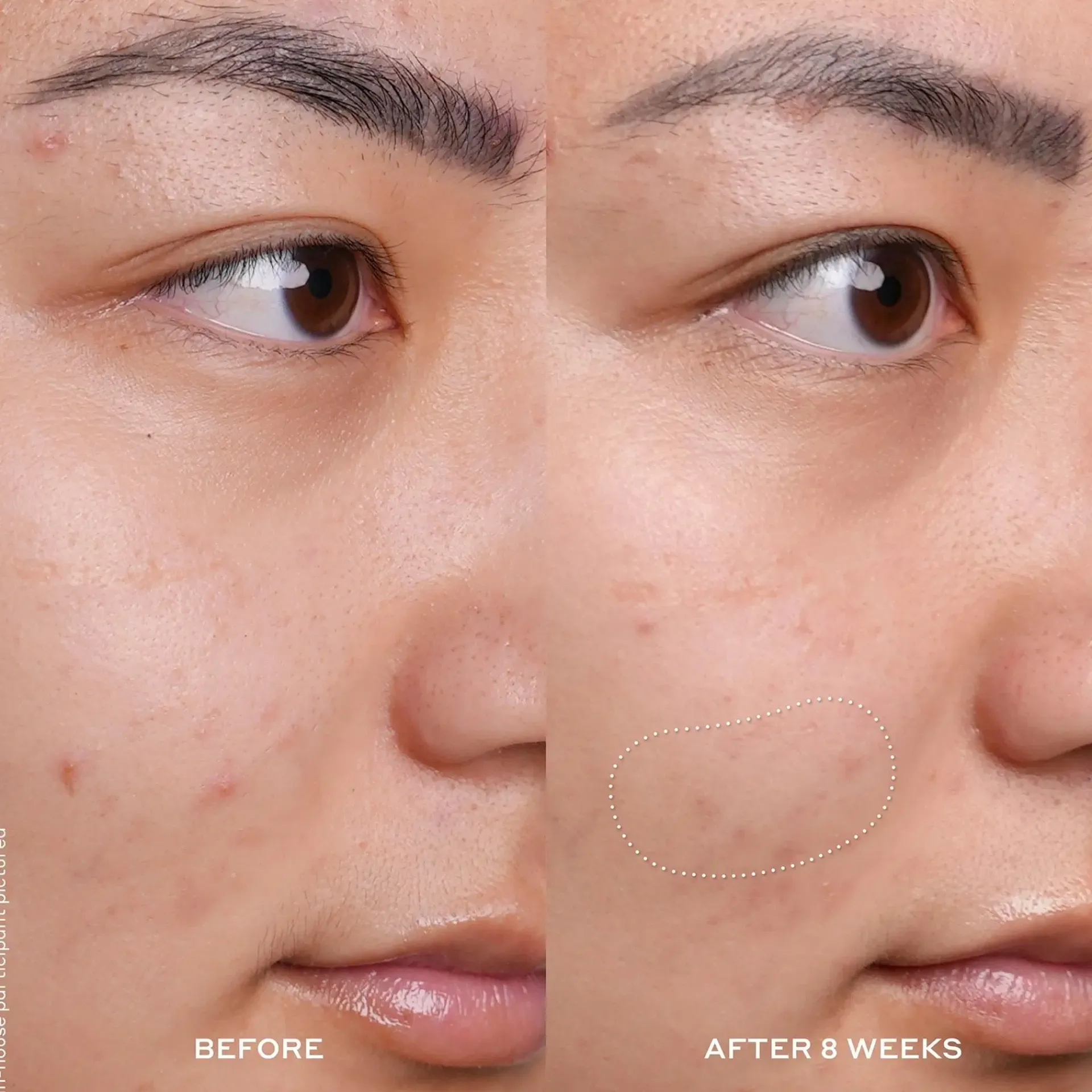 Ole Henriksen Ihonhoidon Tehoaineet|Kasvojenhoito<OleHenriksen Truth Banana Bright ™ Vitamin C seerumi 30 ml