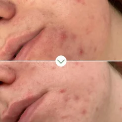 Pai Skincare Ihonhoito|Kasvojenhoito<Pai Phaze Clarifying face wash puhdistustuote 100ml
