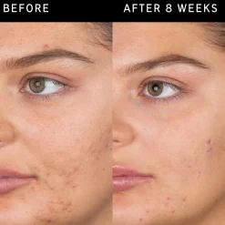 The INKEY List Kasvojenhoito<Salicylic Acid Cleanser puhdistusgeeli 60 ml