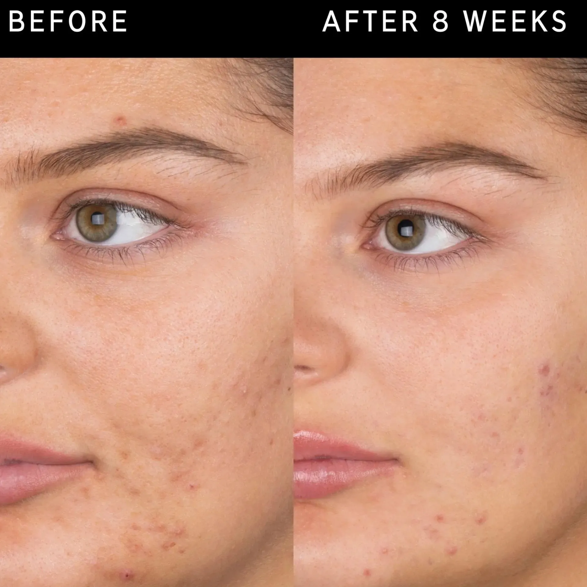 The INKEY List Kasvojenhoito<Salicylic Acid Cleanser puhdistusgeeli 60 ml